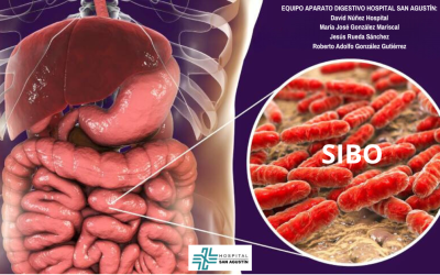 SIBO: ¿Qué es y cómo se prueba en Hospital San Agustín?