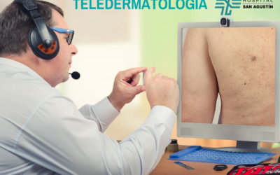 ¿En qué consiste el servicio de Teledermatología en Hospital San Agustín?