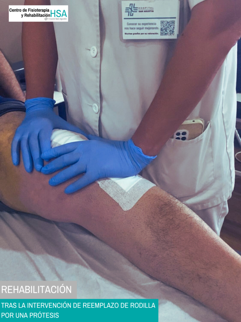 Rehabilitación tras la intervención de reemplazo de rodilla por una prótesis_HOSPITAL SAN AGUSTÍN SEVILLA_01_vertical