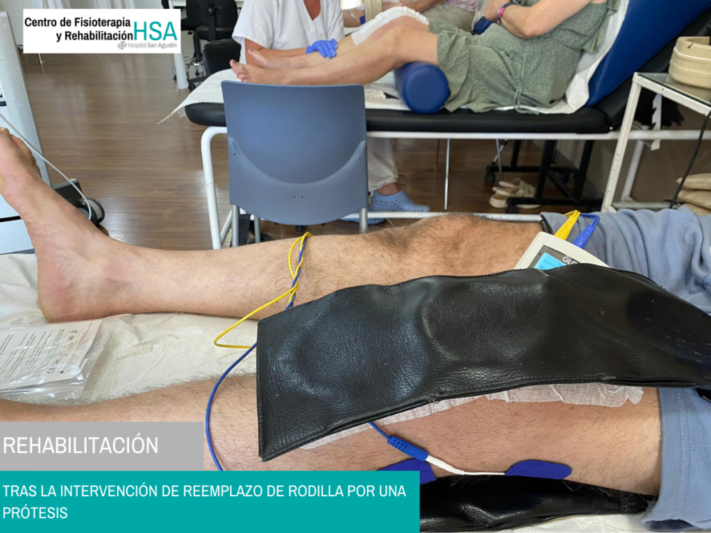 Rehabilitación_Intervención rodilla_Hospital San Agustín_02_horizontal