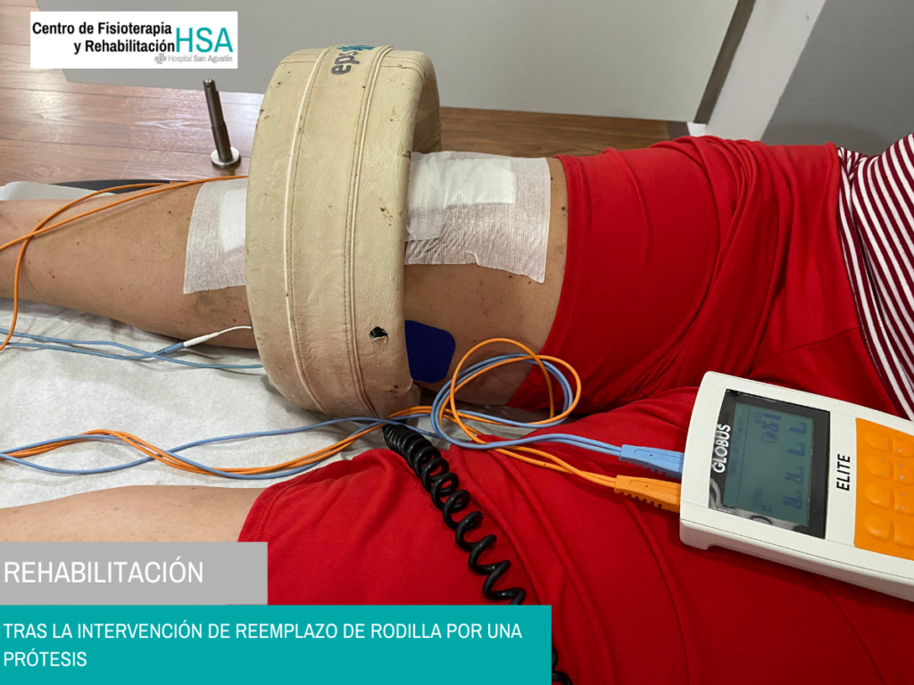 Rehabilitación_Intervención rodilla_Hospital San Agustín_04_horizontal