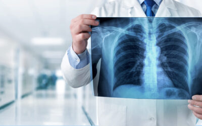Servicio de Radiología 24 horas en Hospital San Agustín