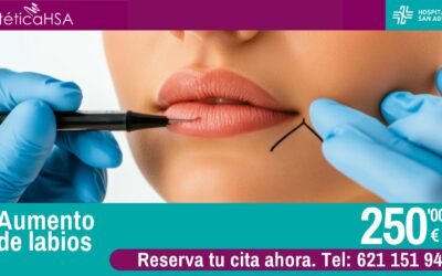 Aumento de labios con ácido hialurónico en Estética HSA: promoción limitada por 250€
