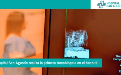 Hospital San Agustín realiza la primera tomobiopsia en el hospital