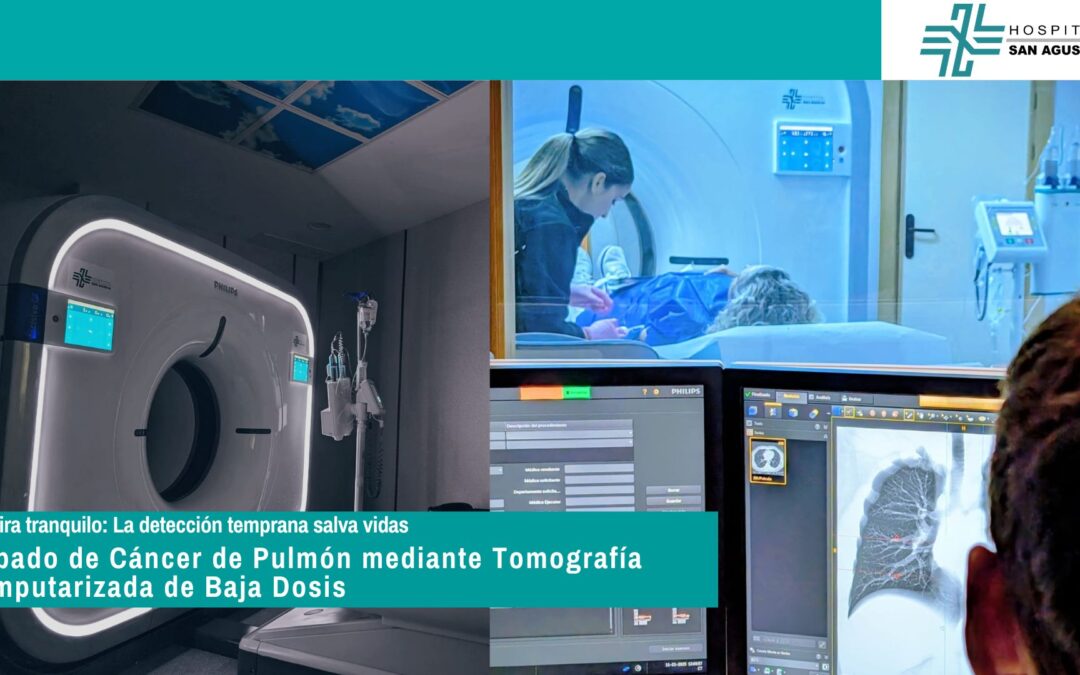 Incorporamos los cribados de Cáncer de Pulmón mediante Tomografía Computarizada de Baja Dosis