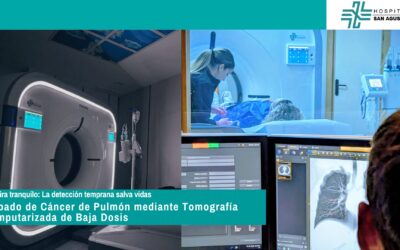 Incorporamos los cribados de Cáncer de Pulmón mediante Tomografía Computarizada de Baja Dosis
