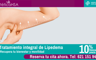Recupera tu bienestar y movilidad con nuestro tratamiento integral de lipedema